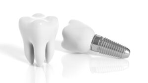 shrewsbury dental implants